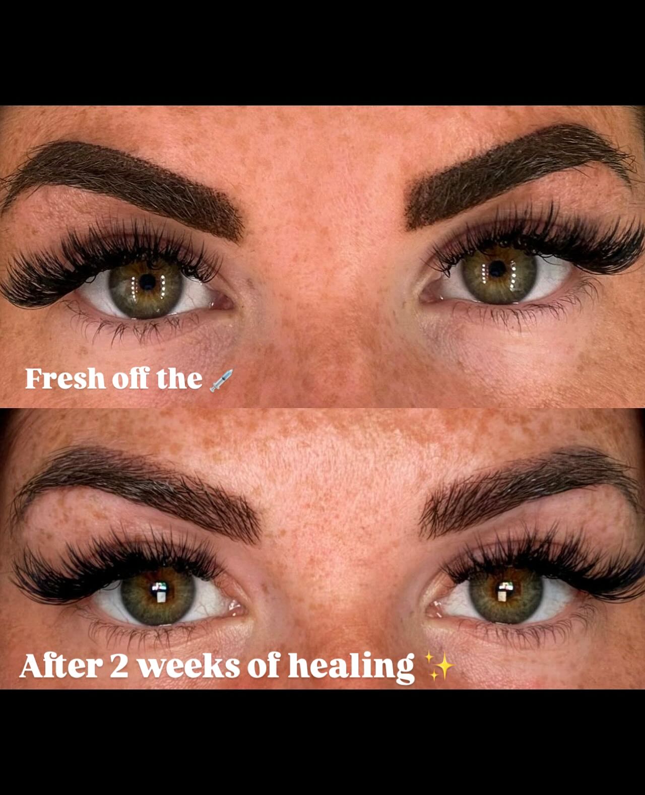 Semi-permanent brow result comparison
