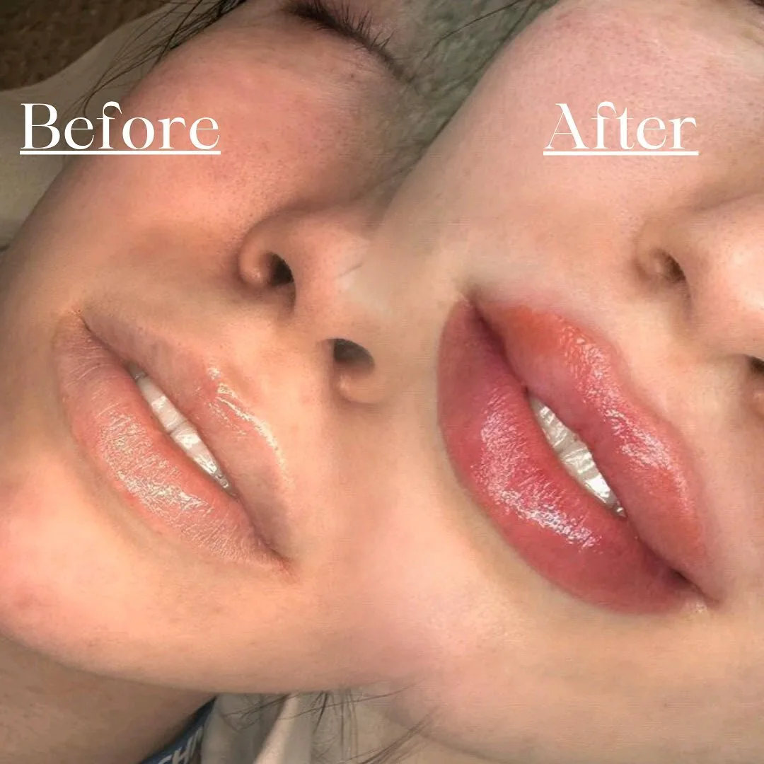 Side-by-side lip blush result before and immediately after treatment
